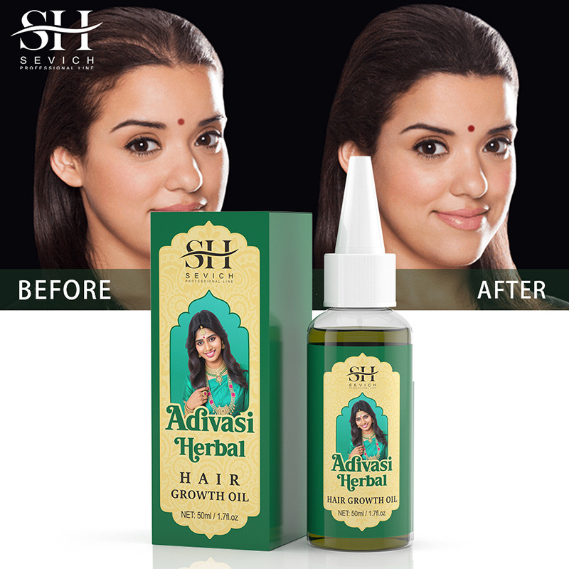 Ayurvedic & Herbal Wellness Kits - 50ml original índia óleo adivasi óleo